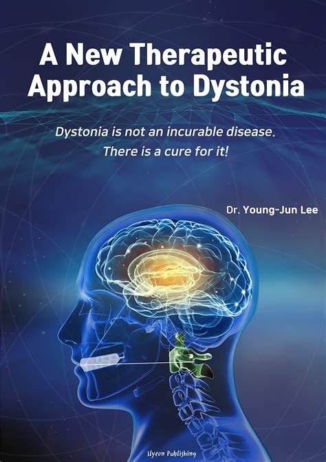 download Dystonia